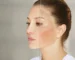 Woman with melasma and sun-induced dark spots on her cheeks, a common concern treated at Touch and Glow Med Spa in Glendale, Arizona.