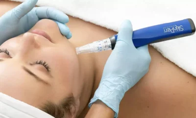 SkinPen-microneedling-treatment-at-Touch-&-Glow-Med-Spa-in-Glendale-AZ